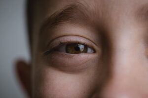 子ども アレルギー 目の症状の原因は何？
